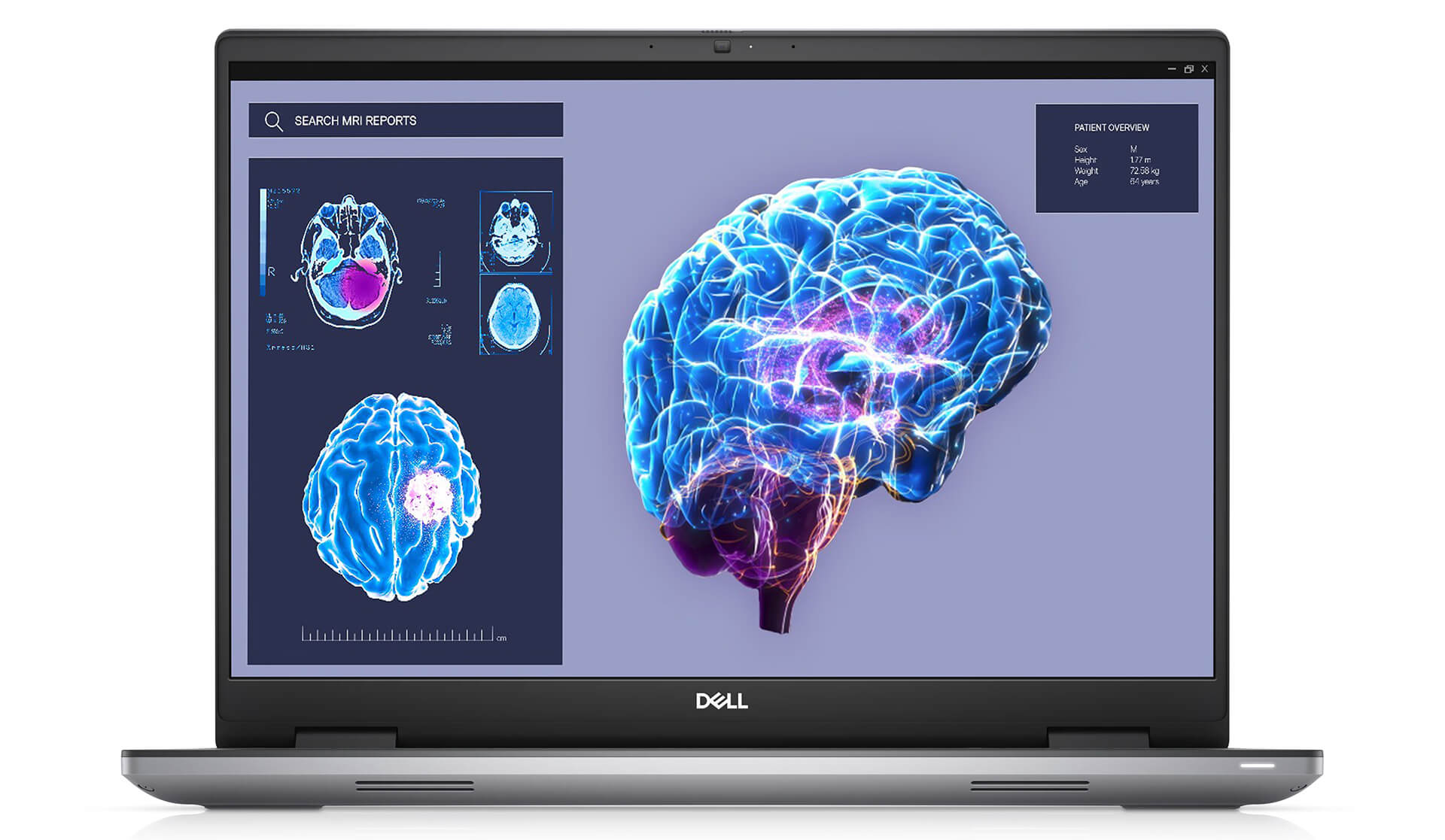 Dell Precision 7680 xử lý đồ họa, kỹ thuật