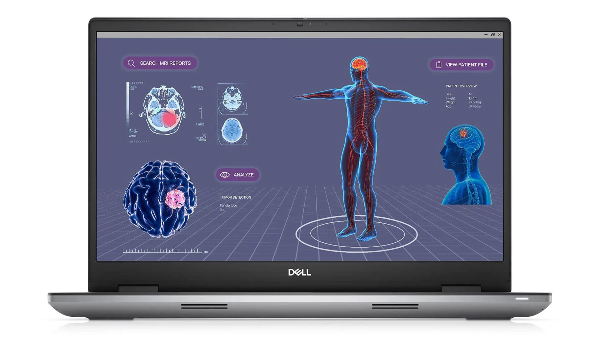 Dell Precision 7780 xử lý đồ họa, kỹ thuật